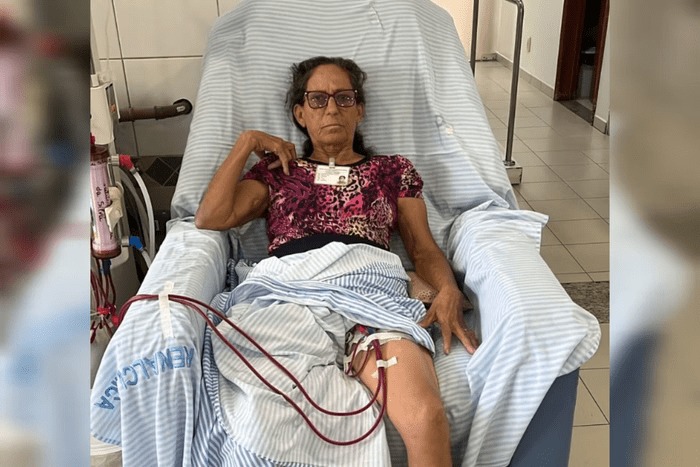 Mulher faz hemodiálise há 20 anos após picada de aranha na infância