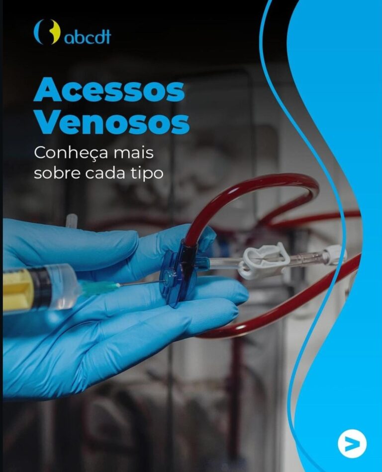 Acessos Venosos